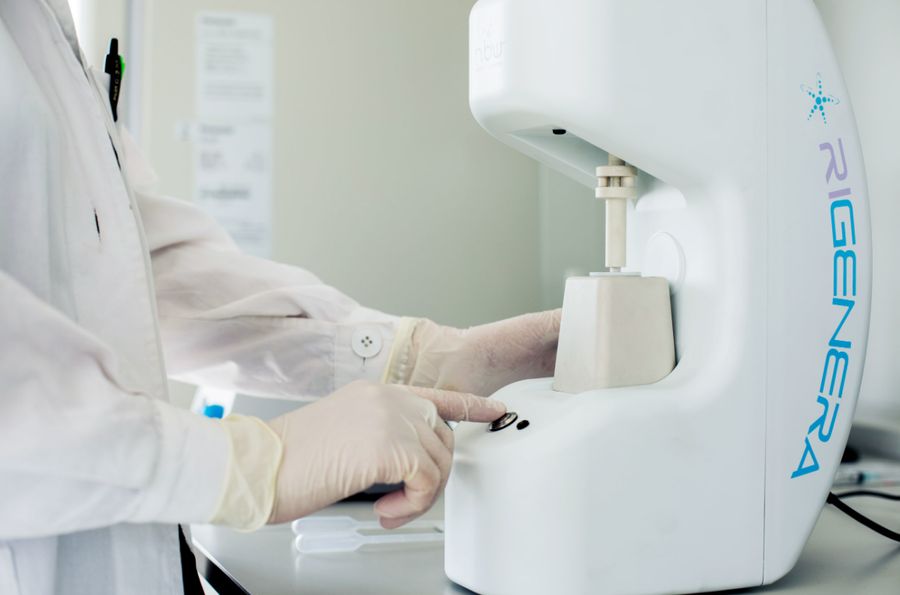 Rigenera Activa for Hair Loss Treatment, Budapest, Hungary